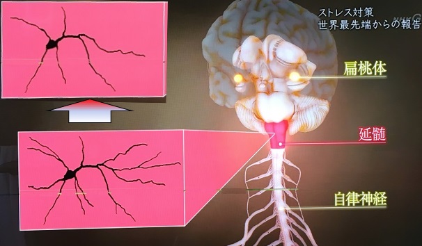扁桃体と神経細胞突起を現したイラスト